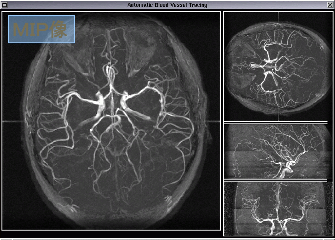 Medical Image